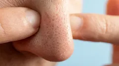 Questo problema preoccupa molti, ma non tutti sanno che si può risolvere facilmente.