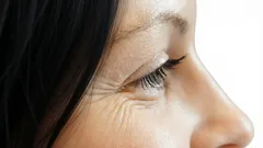 Perché compaiono le rughe nella zona degli occhi: cinque fattori a cui pochi prestano attenzione